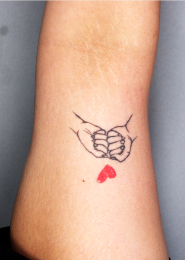 Tatto Cover up Master Page (1) copy